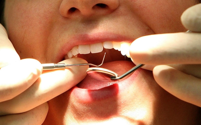 1/3 trẻ em ở Anh bị bệnh răng miệng do thói quen đánh răng sai, cách làm đúng lại là việc người Việt làm mỗi ngày - Ảnh 1.