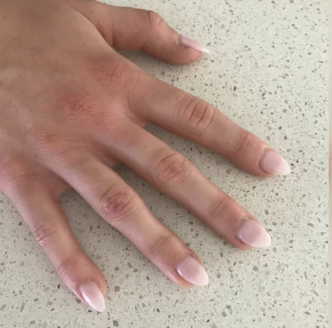 Trường trung học &Uacute;c cấm 70 học sinh dự lễ tốt nghiệp v&igrave; l&agrave;m m&oacute;ng tay giả - Ảnh 1.