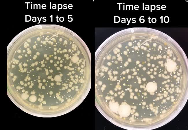 Ai cũng d&ugrave;ng vật n&agrave;y để rửa rau, thực phẩm nhưng kh&ocirc;ng hề biết c&ograve;n bẩn hơn bồn cầu, bệnh truyền nhiễm từ đ&acirc;y m&agrave; ra - Ảnh 2.
