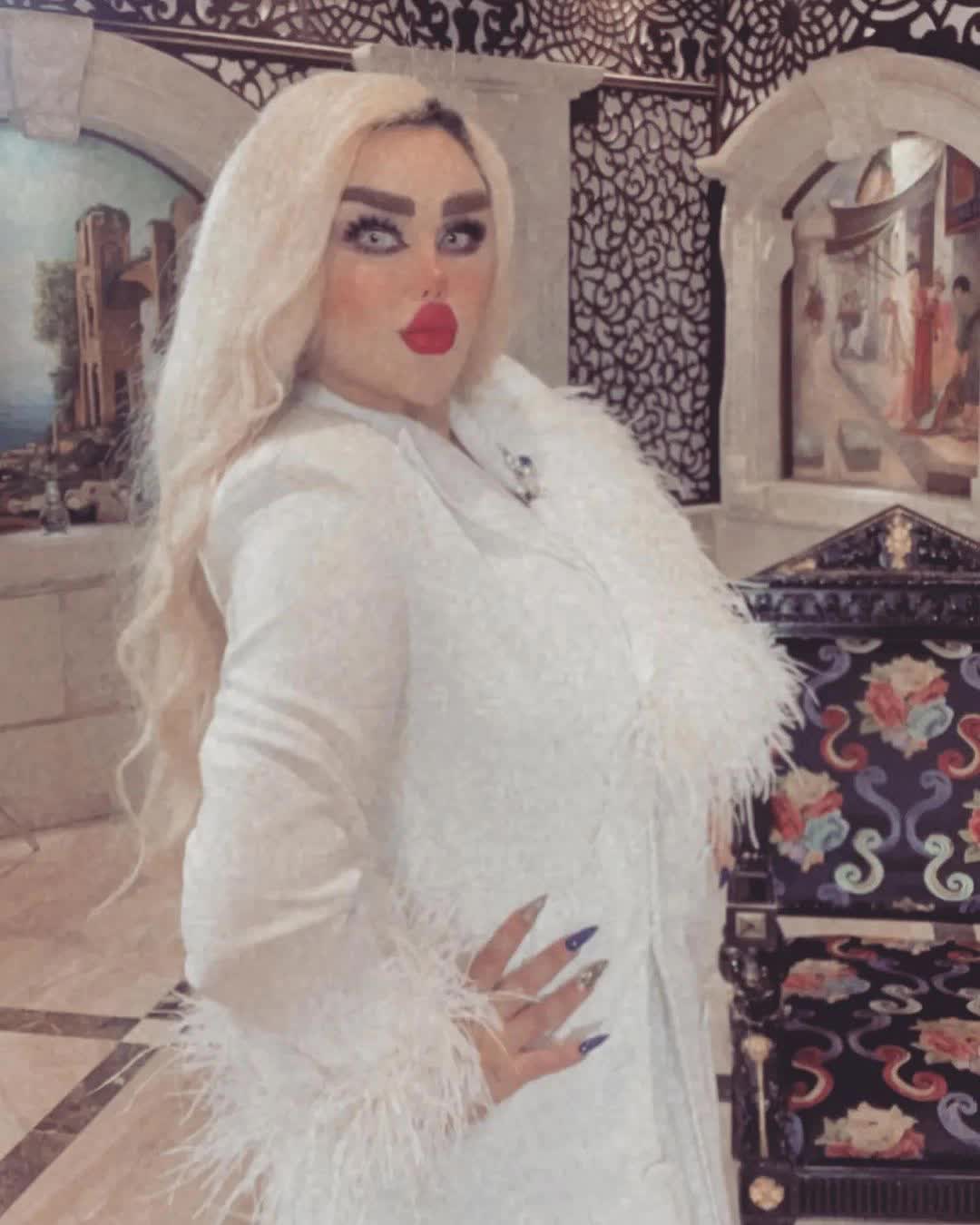 Nghiện phẫu thuật giống búp bê Barbie, người phụ nữ khiến dân mạng hoảng hồn vì gương mặt quái dị - Ảnh 5. Nghiện phẫu thuật giống búp bê Barbie, người phụ nữ khiến dân mạng hoảng hồn vì gương mặt quái dị - Ảnh 5.