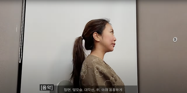 Cháu gái Song Hye Kyo kể chuyện sửa mũi: Đau đến không thở được, cứ tưởng dao kéo hỏng, thành quả sau 3 tháng lại bất ngờ - Ảnh 4.