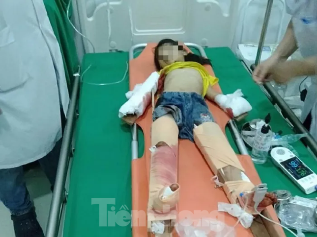 Nỗi đau của người bố có 3 con nhỏ nguy kịch sau vụ nổ kinh hoàng tại gara ô tô ở Nghệ An - Ảnh 2.