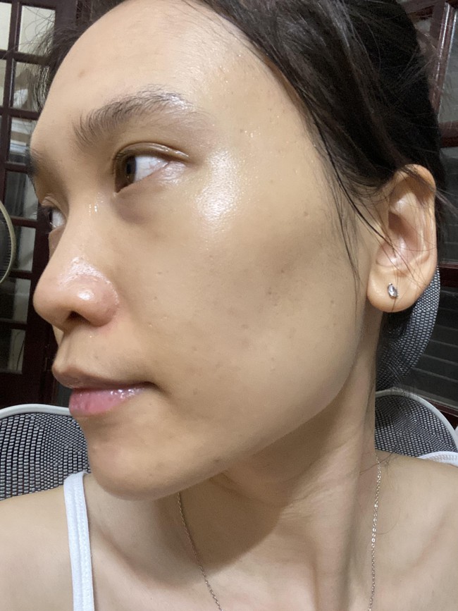 Đánh giá cặp đôi giúp giảm mụn chiết xuất cà rốt: Hiệu quả thấy rõ chỉ sau 2 tuần, tuy nhiên vẫn có 1 điểm trừ nhỏ - Ảnh 6.