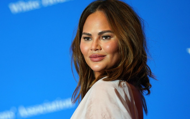 Chrissy Teigen tức giận trước tin đồn phẫu thuật thẩm mỹ - Ảnh 2.