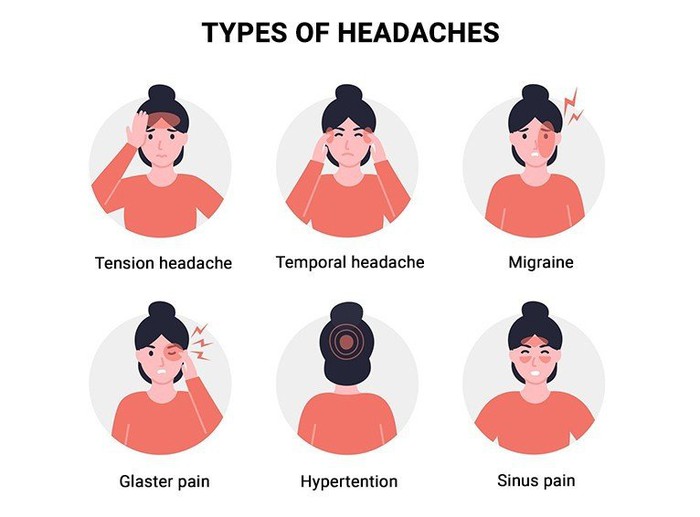 Nhiều người đối mặt cơn đau đầu - đau nửa đầu Migraine nhưng không hiểu tường tận về bệnh - Ảnh 2.