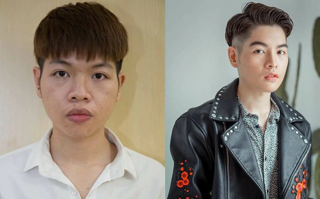 Sao nam từng bị ám ảnh ngoại hình nhưng sự nghiệp quay ngoắt 180 độ nhờ phẫu thuật thẩm mỹ - Ảnh 4.