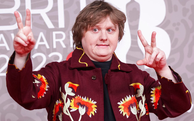 Lewis Capaldi hủy tất cả các buổi biểu diễn vì vấn đề sức khỏe - Ảnh 1.