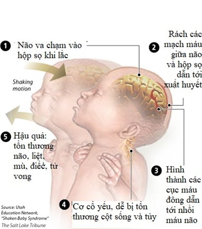 Bác sĩ: Có thể nghi ngờ trẻ bị bạo hành dựa vào sự kết hợp những dấu hiệu sau - Ảnh 2.