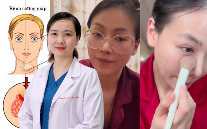 Bệnh cường gi&aacute;p của hoa hậu Phương Kh&aacute;nh c&oacute; g&acirc;y ra nhiều biến chứng nguy hiểm?