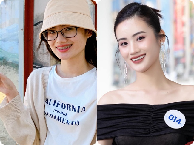 Tân Miss World Việt Nam Huỳnh Nhi “lên đời” nhan sắc nhờ niềng răng - Ảnh 7.