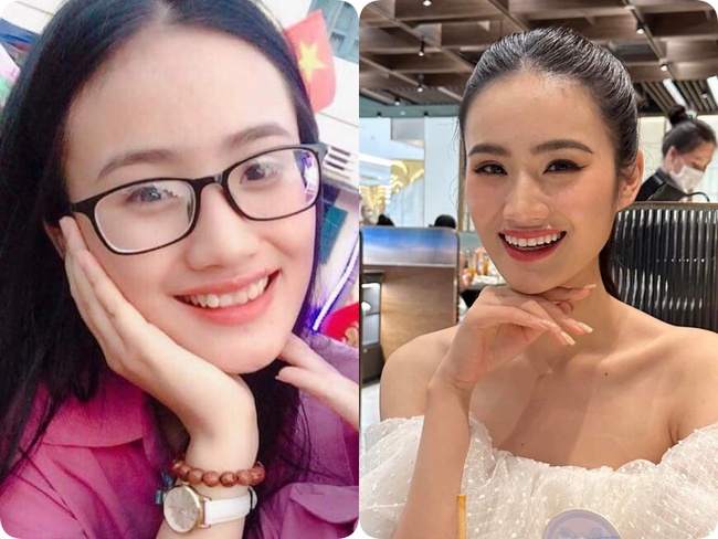 Tân Miss World Việt Nam Huỳnh Nhi “lên đời” nhan sắc nhờ niềng răng - Ảnh 6.