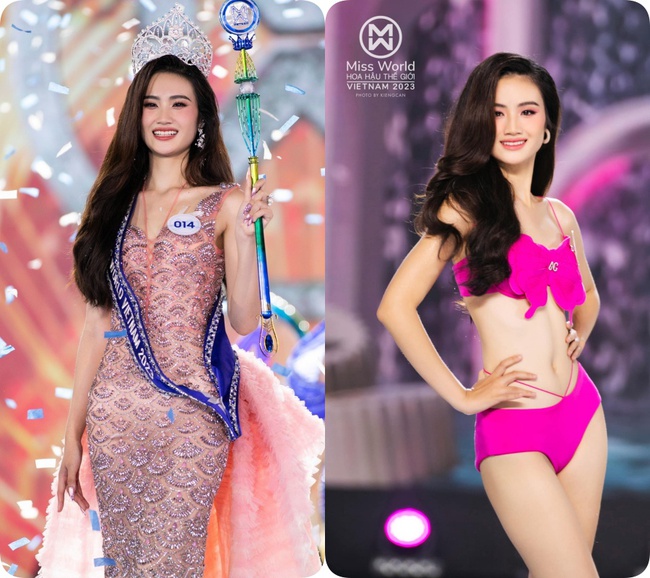 Tân Miss World Việt Nam Huỳnh Nhi “lên đời” nhan sắc nhờ niềng răng - Ảnh 1.
