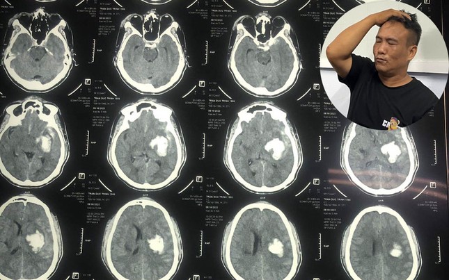 Th&ocirc;ng tin về vụ nghi phạm đi cấp cứu sau khi bị tạm giữ tại C&ocirc;ng an Đồ Sơn - Ảnh 1.