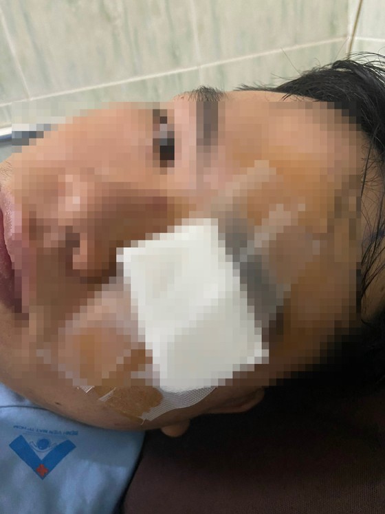 Thanh niên tố CSGT dùng gậy tác động bị thương được xác định lỗi vi phạm tốc độ - Ảnh 2.
