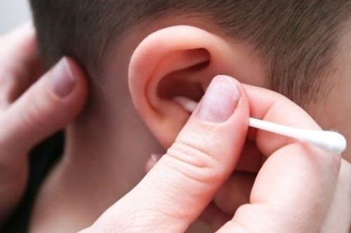 Bé trai 5 tuổi bị thủng màng nhĩ do ngoáy tai - Ảnh 1.