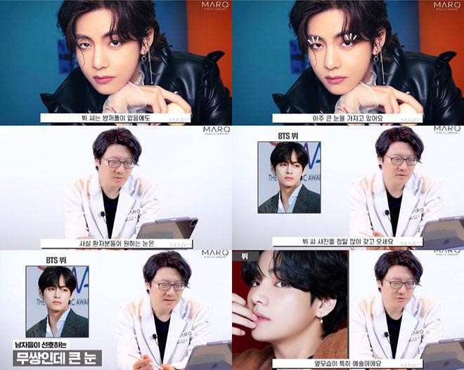 Nét tự nhiên của V (BTS) không thể phẫu thuật mà có được - Ảnh 4.