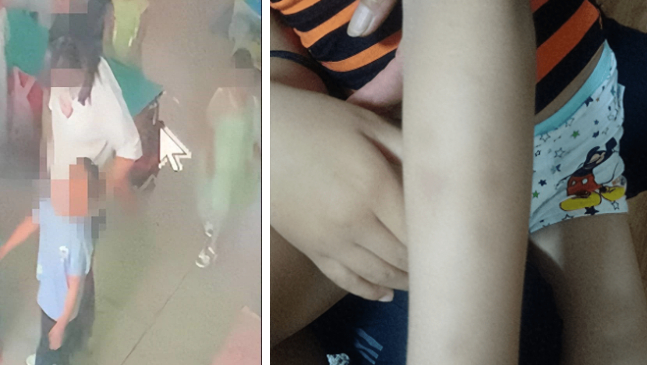 Con trai 5 tuổi đi học 17 ng&agrave;y bị đ&aacute;nh 130 lần, phụ huynh xem camera ở trường xong lập tức b&aacute;o cảnh s&aacute;t - Ảnh 2.