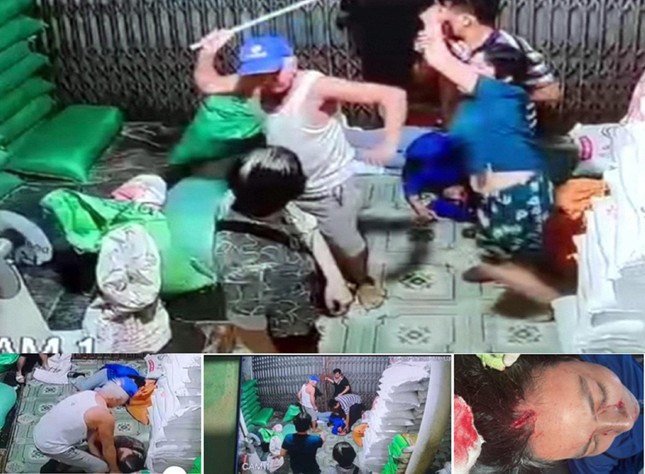 Con d&acirc;u nhập viện nghi bị bố chồng 81 tuổi đ&aacute;nh - Ảnh 1.