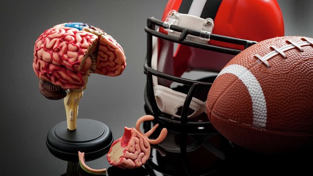 Một bệnh lý về não nguy hiểm có thể gặp ở những người chơi các môn thể thao này - Ảnh 1.