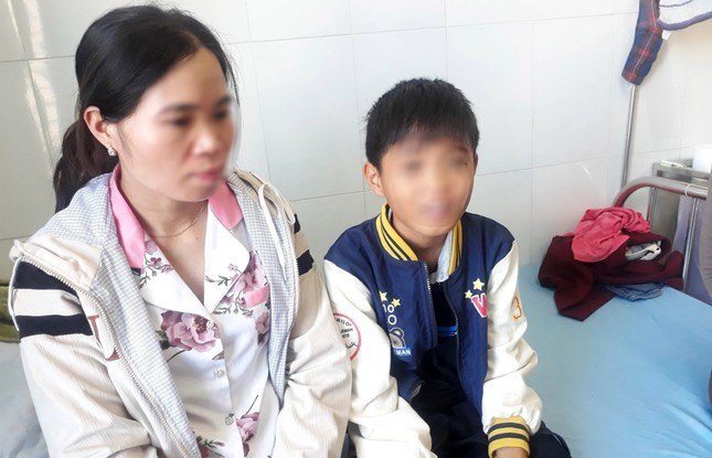 Nam sinh lớp 6 bị bạn cùng lớp đánh bầm tím cơ thể - Ảnh 1.