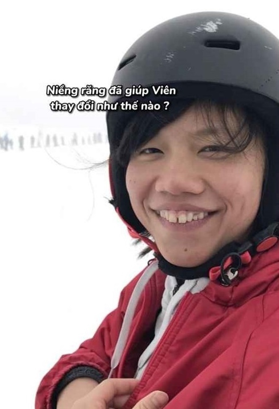 Không phải niềng răng, dân mạng chỉ ra điểm đặc biệt giúp Ánh Viên xinh đẹp xuất sắc- Ảnh 2. Không phải niềng răng, dân mạng chỉ ra điểm đặc biệt giúp Ánh Viên xinh đẹp xuất sắc- Ảnh 2.
