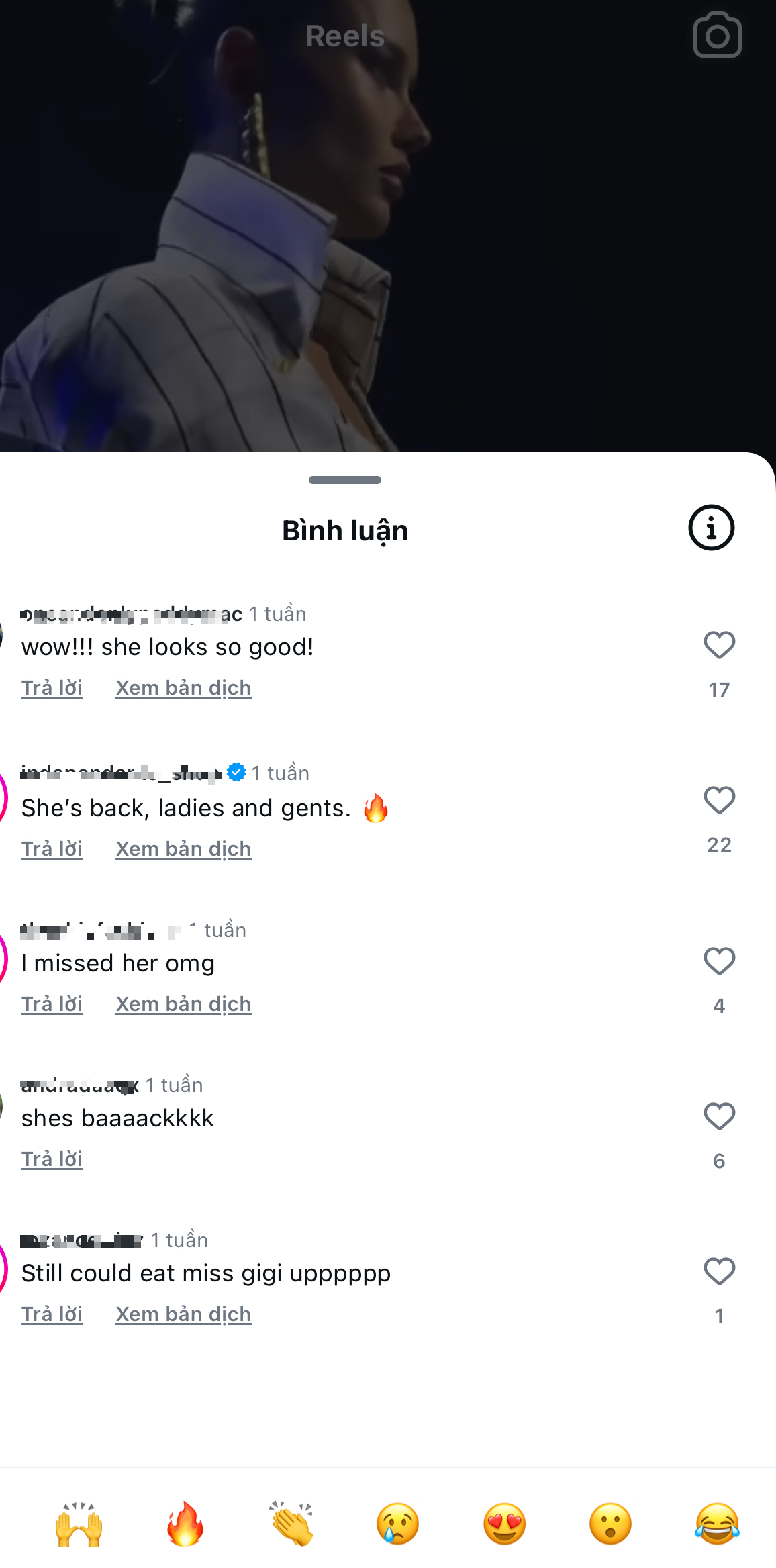 Siêu mẫu Victoria's Secret gây sốc với khuôn mặt biến dạng, từng có ước mơ không ai ngờ- Ảnh 36.