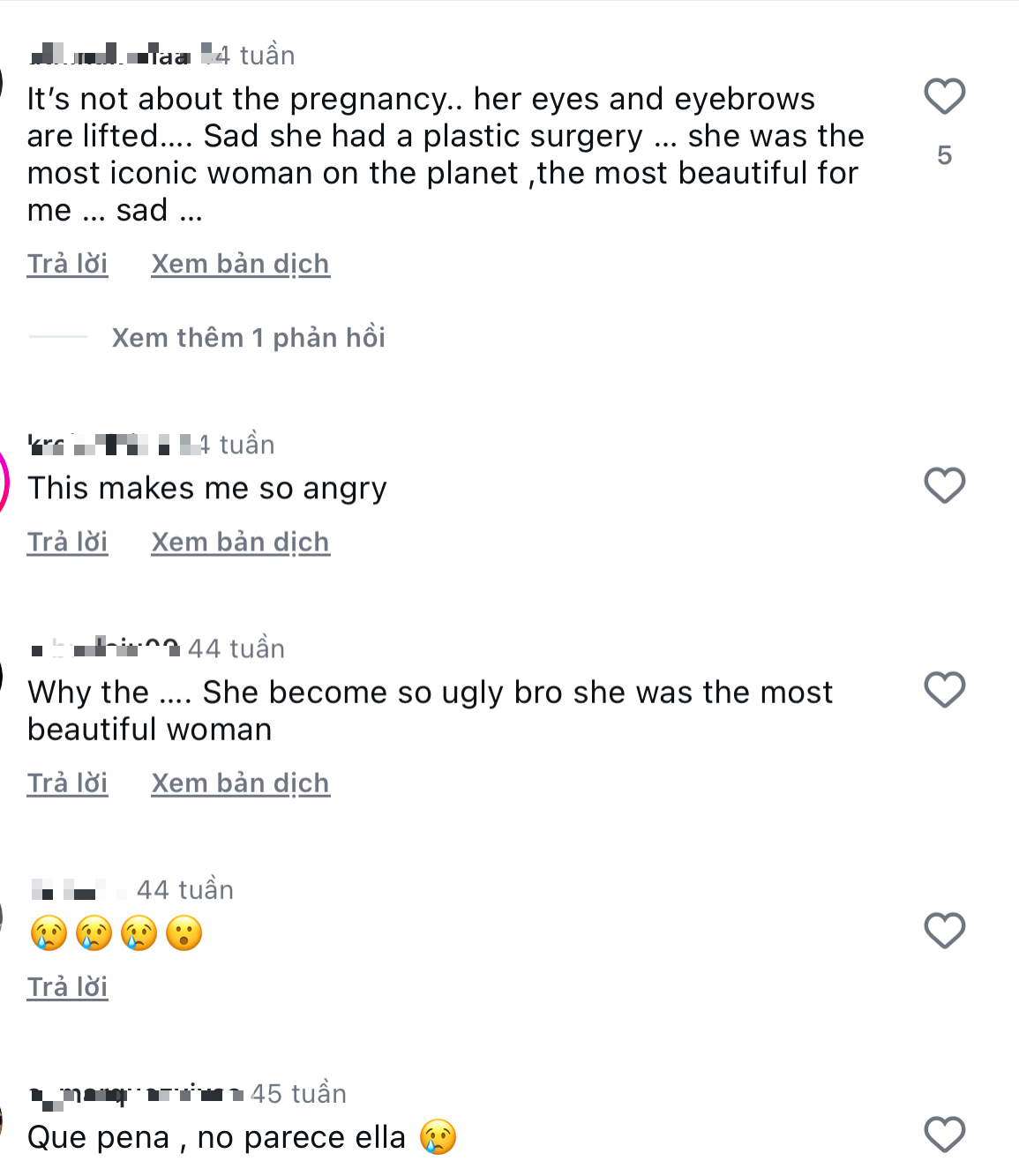 Siêu mẫu Victoria's Secret gây sốc với khuôn mặt biến dạng, từng có ước mơ không ai ngờ- Ảnh 22.