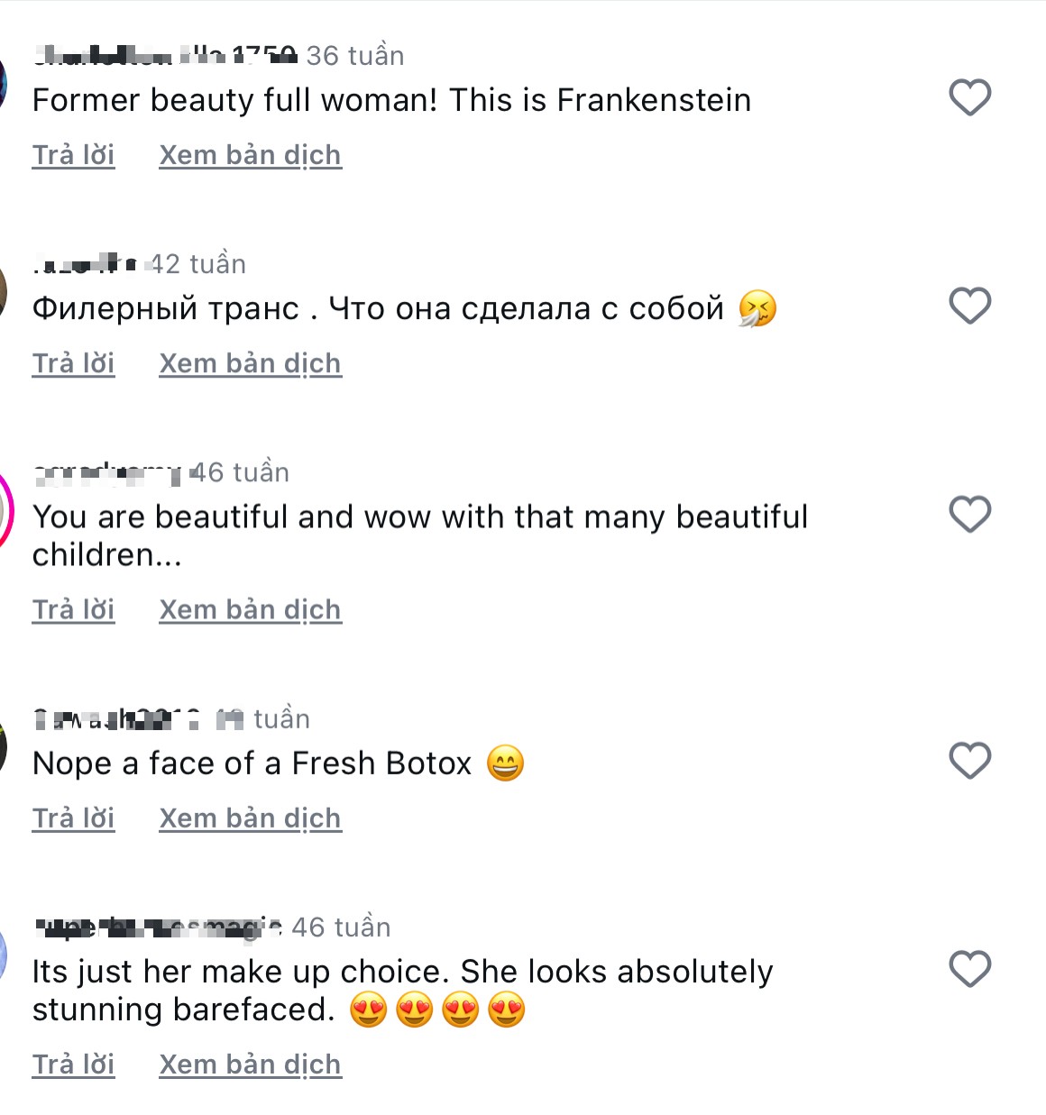 Siêu mẫu Victoria's Secret gây sốc với khuôn mặt biến dạng, từng có ước mơ không ai ngờ- Ảnh 24.