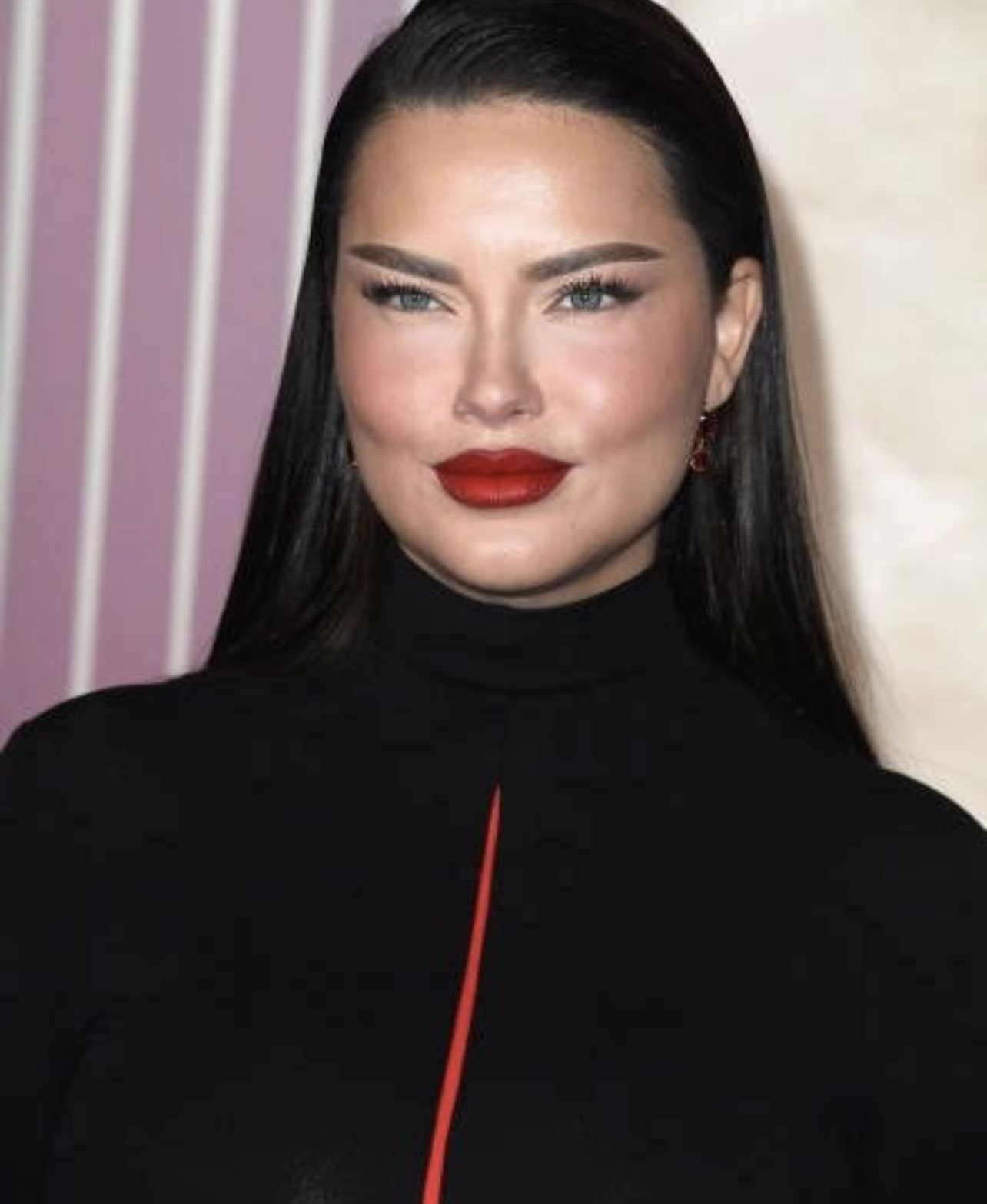 Siêu mẫu Victoria's Secret gây sốc với khuôn mặt biến dạng, từng có ước mơ không ai ngờ- Ảnh 20.