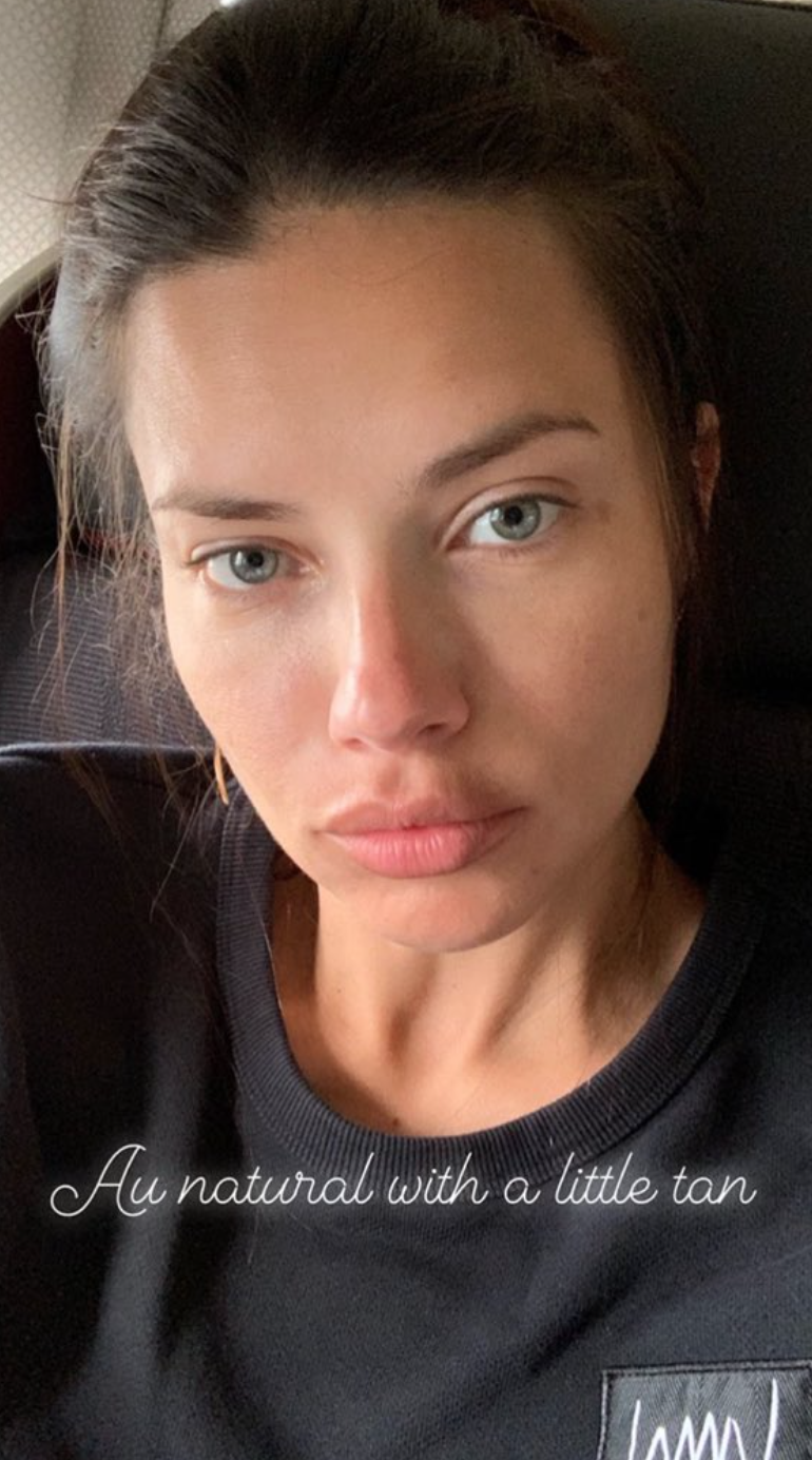 Siêu mẫu Victoria's Secret gây sốc với khuôn mặt biến dạng, từng có ước mơ không ai ngờ- Ảnh 29.