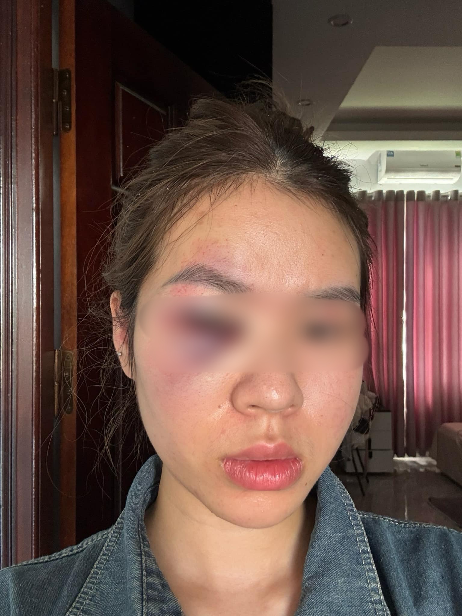 Vụ đi trang điểm đám cưới, thợ makeup tố bị em gái cô dâu "tương tác" bầm tím mắt: Hai bên nói gì?- Ảnh 2.