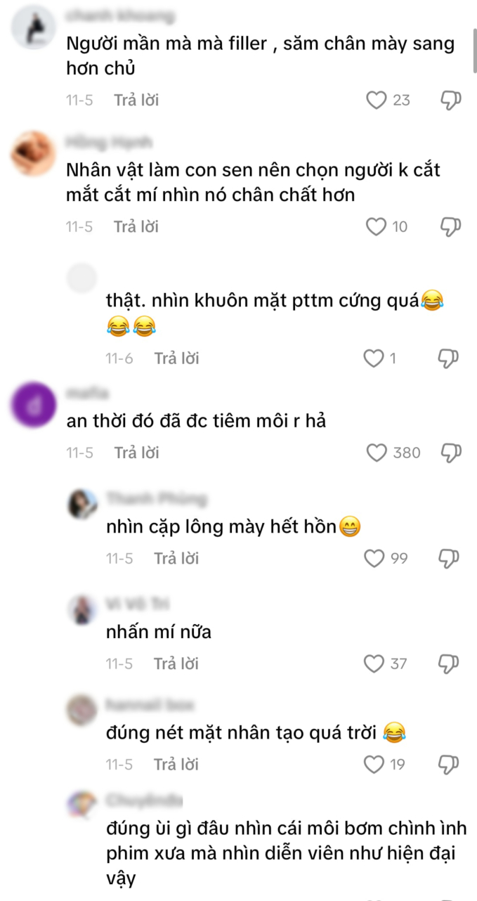 Mỹ nhân cổ trang Việt bị chê bai vì dao kéo quá lố, netizen ngán ngẩm “thời đó đã có tiêm môi rồi hả?”- Ảnh 3.