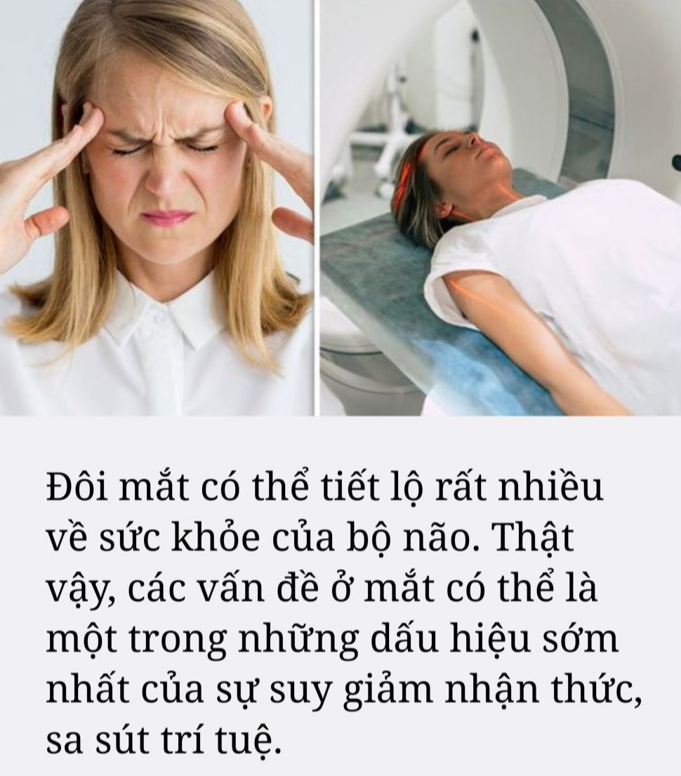 Gặp dấu hiệu này khi nhìn, rất có thể bạn đang bị sa sút trí tuệ, các nhà thần kinh học khuyên làm một việc- Ảnh 1.