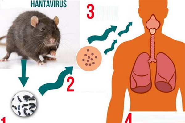 300 ống chứa virus nguy hiểm chết người ở Australia là những virus gây bệnh gì?- Ảnh 4.