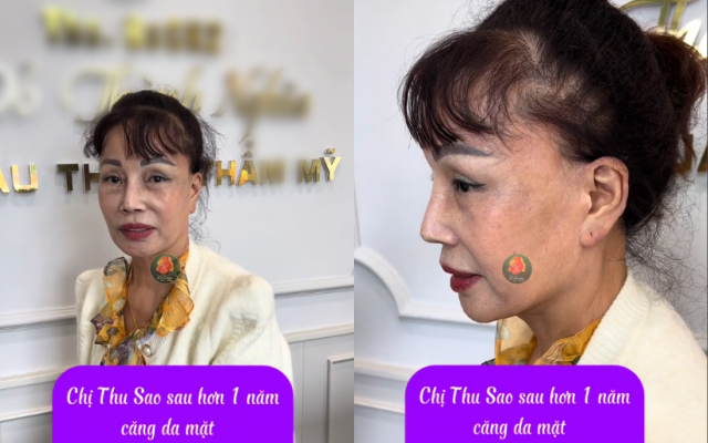 Bất ngờ nhan sắc của cô dâu Thu Sao sau nhiều lần "trùng tu", cuộc sống với chồng trẻ kém 36 tuổi hiện ra sao?- Ảnh 1.