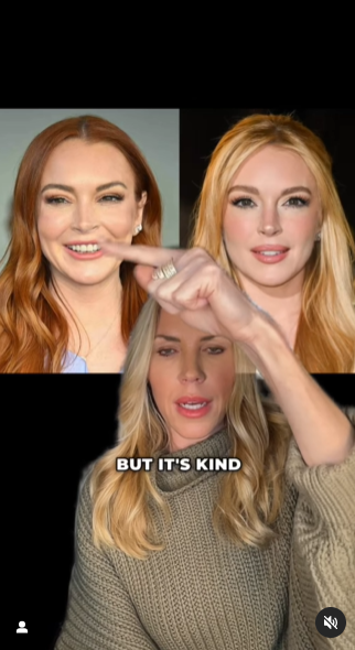 Bí ẩn của "thần dược cải lão hoàn đồng": Cách Lindsay Lohan và loạt sao Hollywood sử dụng để cứu vớt nhan sắc tới ngày "cận date"?- Ảnh 8.