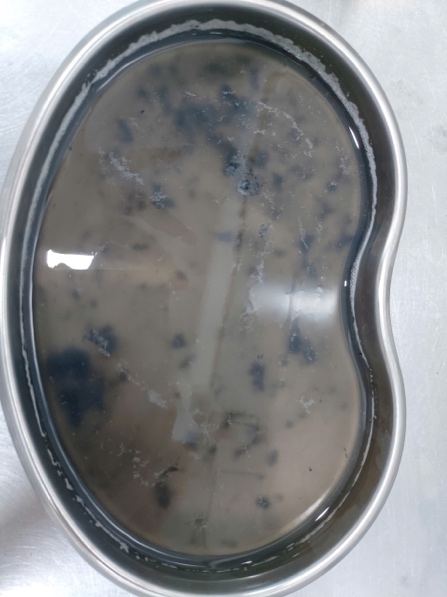 Vụ phóng hoả khiến 11 người tử vong: Các nạn nhân nhập viện trong tình trạng tiên lượng nặng, có thể tử vong cao- Ảnh 4.