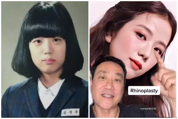 Sao nữ đẹp nhất thế giới năm 2024: Lần thứ 3 li&ecirc;n tiếp gi&agrave;nh ng&ocirc;i vị đầu bảng, b&iacute; mật về can thiệp "dao k&eacute;o" được b&aacute;c sĩ tiết lộ- Ảnh 4.