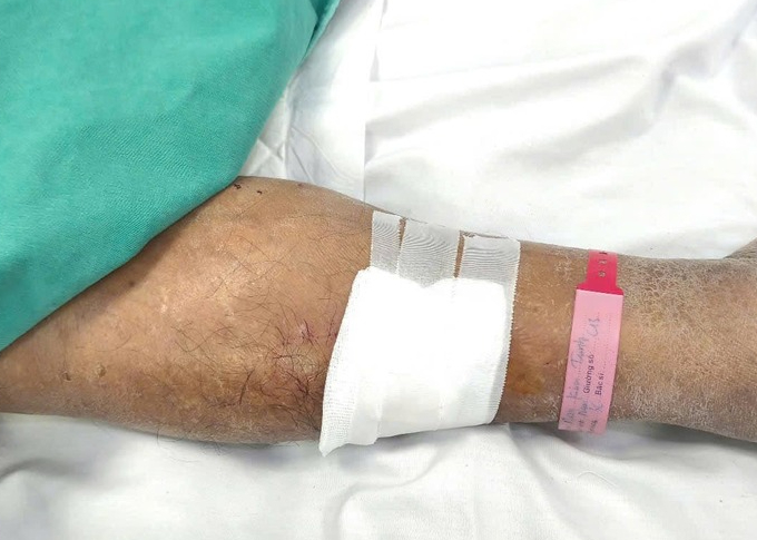 Ng&atilde; v&agrave;o gốc c&acirc;y, người đ&agrave;n &ocirc;ng bị uốn v&aacute;n nguy kịch- Ảnh 2.