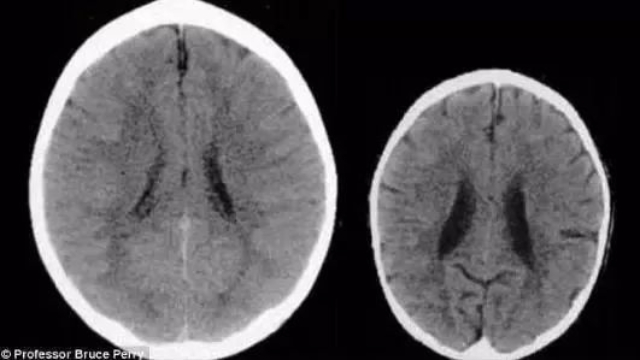 Những thay đổi đáng kinh ngạc về IQ của trẻ sau khi bị cha mẹ đánh mắng- Ảnh 2.