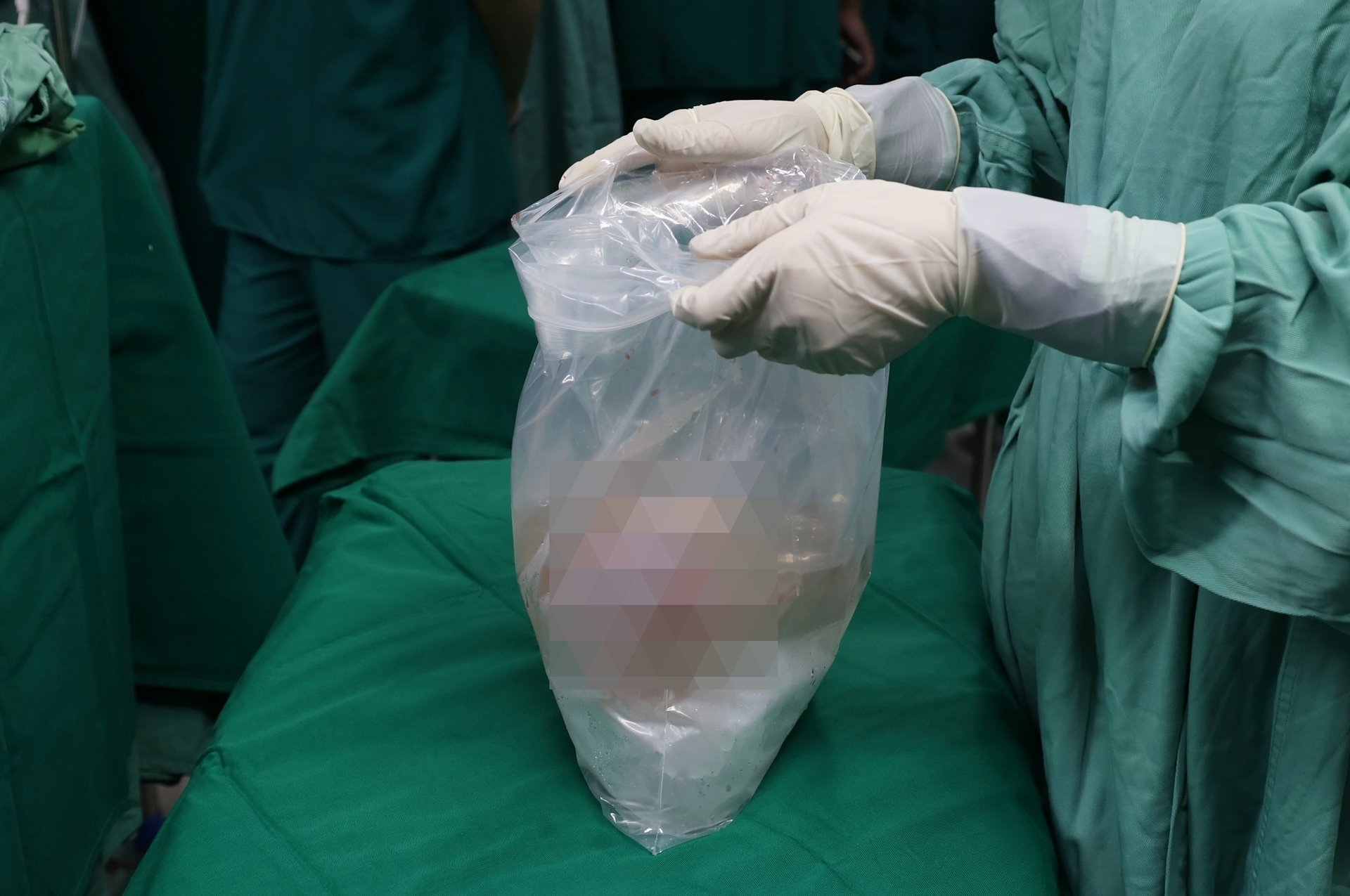 Ca đại phẫu của 60 y b&aacute;c sĩ để người đ&agrave;n &ocirc;ng chết n&atilde;o trao đi "m&oacute;n qu&agrave; sự sống"- Ảnh 7.