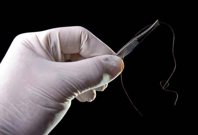 Chàng trai Việt kiều cầm 2 sợi tóc đi xét nghiệm ADN: Đọc kết quả xong chỉ biết buồn - Ảnh 1.