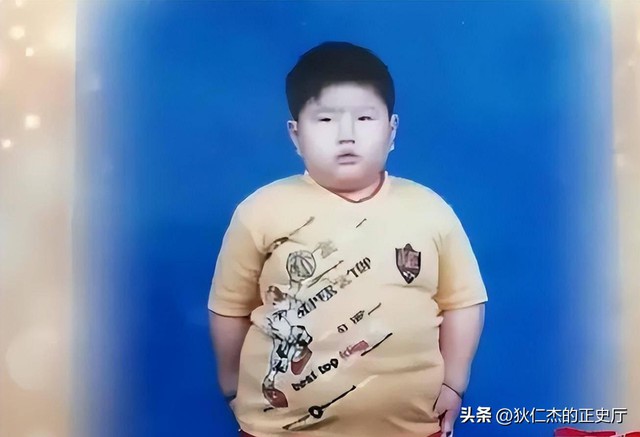Cậu bé nặng nhất Trung Quốc 14 tuổi đã 150kg, có thể ăn 1 thùng mì gói 1 ngày có kết cục ra sao? - Ảnh 1.