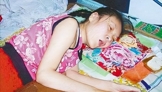 Bị anh trai t&aacute;t 2 ph&aacute;t, c&ocirc; g&aacute;i giả vờ bại liệt gần 20 năm, sự thật được vạch trần nhờ chi tiết lạ - Ảnh 3.