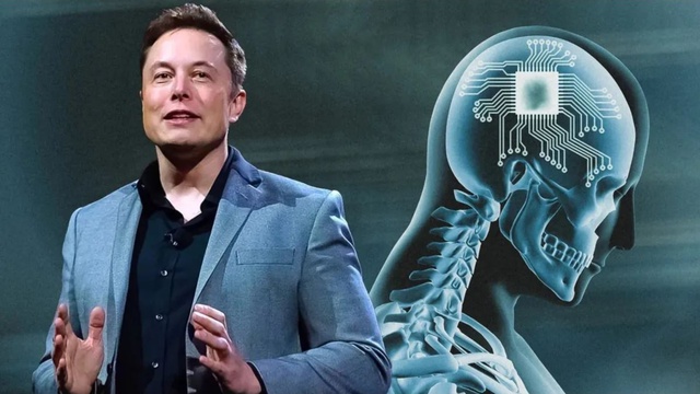 Hợp nhất não người với AI: Chúng ta sẽ phải trả giá bằng tính mạng vì kế hoạch điên rồ của Elon Musk? - Ảnh 1.