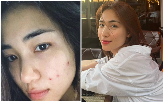 Nếu kh&ocirc;ng thể uống nước diếp c&aacute; giống Ho&agrave; Minzy, chị em d&ugrave;ng mỹ phẩm chứa th&agrave;nh phần n&agrave;y cũng &ldquo;okelah&rdquo; lắm - Ảnh 1.