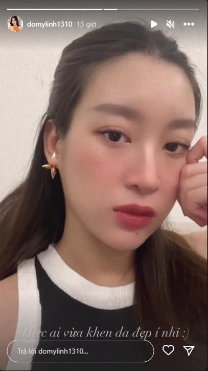 Hoa hậu Đỗ Mỹ Linh công khai tiêm thẩm mỹ, khoe cận gương mặt gây chú ý - Ảnh 4.