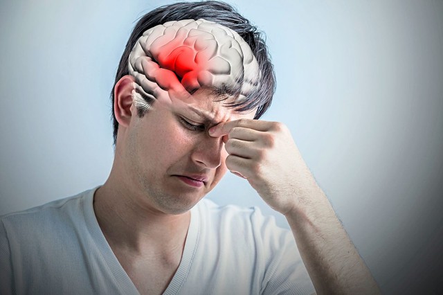 Người đàn ông suýt chết sau một cơn đau đầu: BS cảnh báo người có 1 trong 7 đặc điểm này cần cẩn trọng - Ảnh 3.
