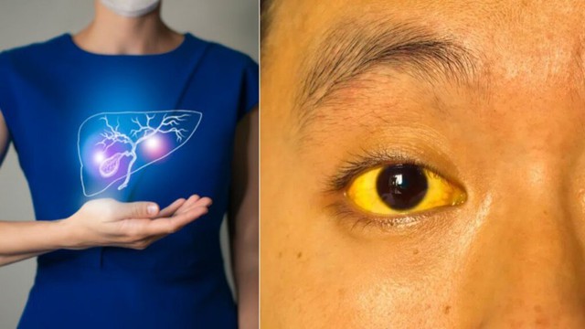 Người “đoản thọ” thường có 5 đặc điểm t…