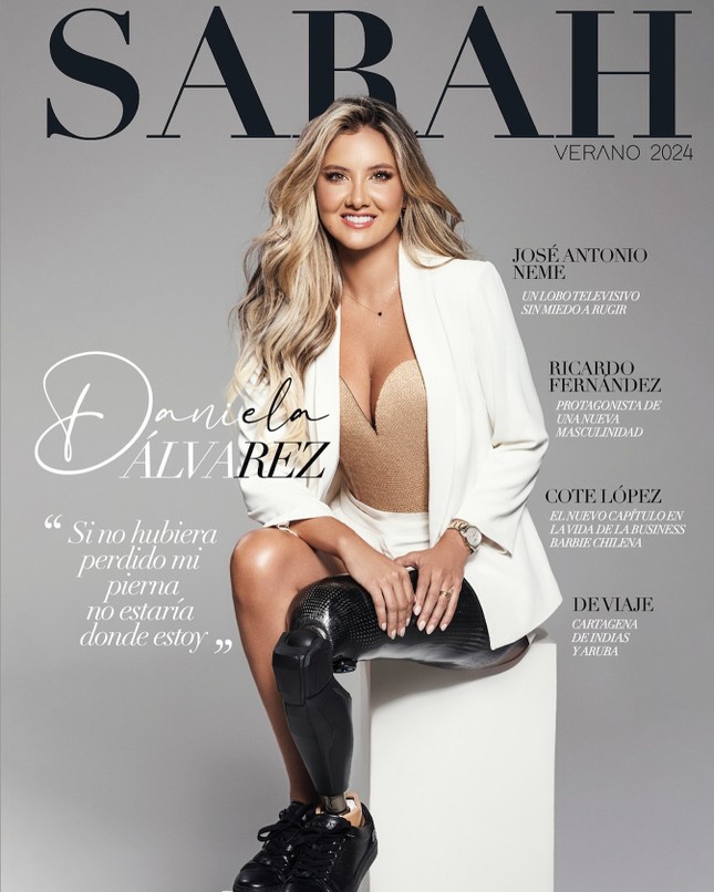 Hoa hậu Colombia thi chạy 10 km bằng chân giả - Ảnh 4.